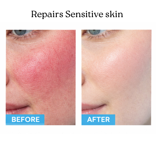 BLUELAB™ Sensitive Skin Moisturizer Fragrance Free (50ml)