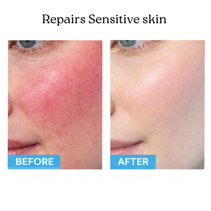 BLUELAB™ Sensitive Skin Moisturizer Fragrance Free (50ml)